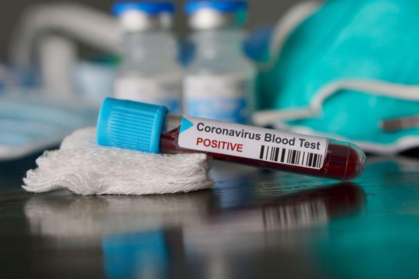 India reports 9,851 new coronavirus cases in a single day